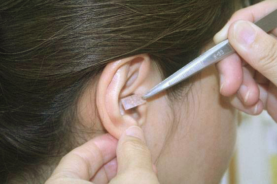 耳つぼ施術2